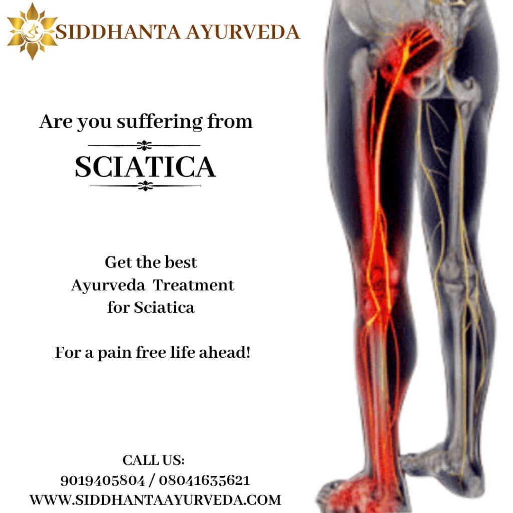 ayurvedic treatment for sciatica at siddhanta ayurveda bangalore